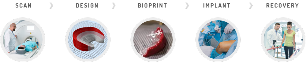 3D Bioprinted Meniscus Tissue